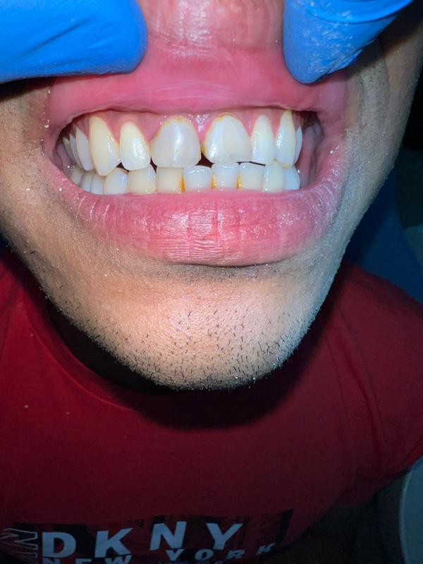 After